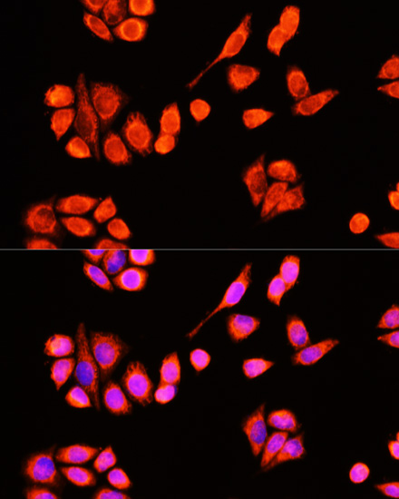 Immunofluorescence analysis of Hela cells using DNAJC19 Polyclonal Antibody at dilution of  1:100 (40x lens). Blue: DAPI for nuclear staining.