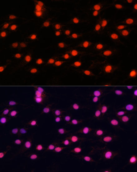 Immunofluorescence analysis of C6 cells using ZNF433 Polyclonal Antibody at dilution of  1:100 (40x lens). Blue: DAPI for nuclear staining.