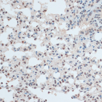 Immunohistochemistry of paraffin-embedded Mouse lung using ZNF433 Polyclonal Antibody at dilution of  1:100 (40x lens).