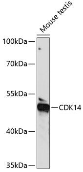 Western blot analysis of extracts of Mouse testis using CDK14 Polyclonal Antibody at dilution of 1:1000.