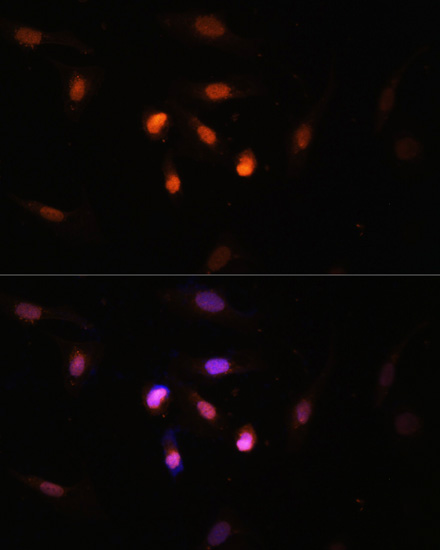 Immunofluorescence analysis of U2OS cells using KAT6A Polyclonal Antibody at dilution of  1:100. Blue: DAPI for nuclear staining.