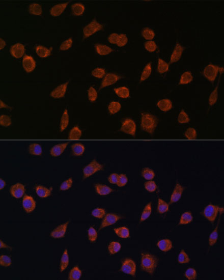 Immunofluorescence analysis of L929 cells using ACSS1 Polyclonal Antibody at dilution of  1:100. Blue: DAPI for nuclear staining.
