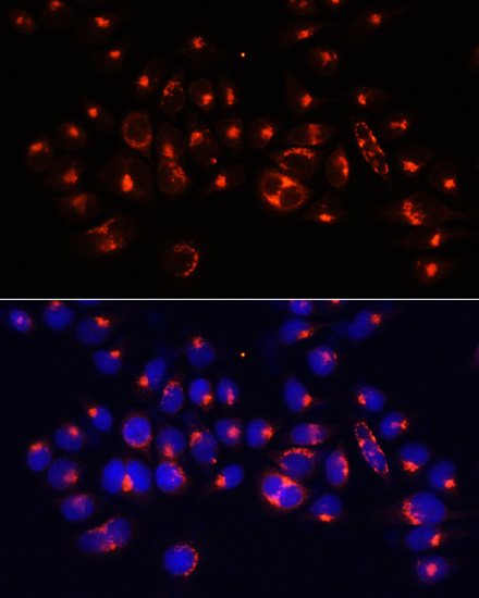 Immunofluorescence analysis of 293T cells using AARS Polyclonal Antibody at dilution of  1:100 (40x lens). Blue: DAPI for nuclear staining.