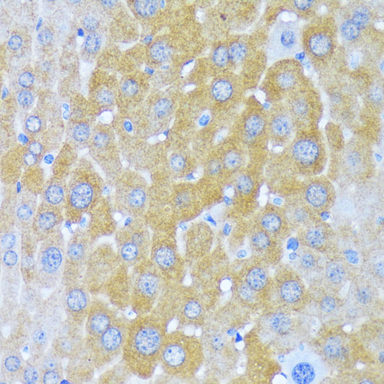 Immunohistochemistry of paraffin-embedded Mouse liver using AARS Polyclonal Antibody at dilution of  1:100 (40x lens).