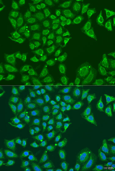 Immunofluorescence analysis of U2OS cells using ALDH1B1 Polyclonal Antibody at dilution of  1:100. Blue: DAPI for nuclear staining.