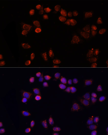 Immunofluorescence analysis of HeLa cells using SLC25A4 Polyclonal Antibody at dilution of  1:100 (40x lens). Blue: DAPI for nuclear staining.