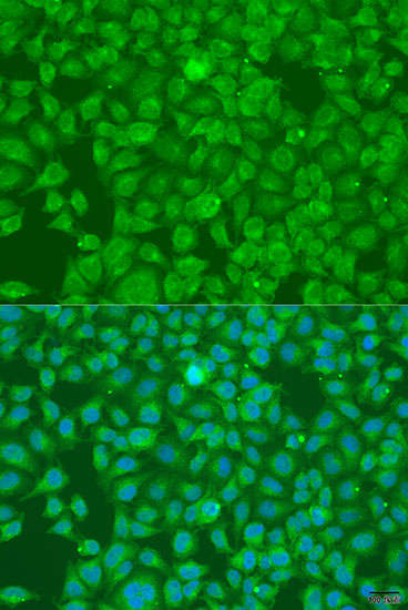 Immunofluorescence analysis of U2OS cells using SLC25A6 Polyclonal Antibody at dilution of  1:100. Blue: DAPI for nuclear staining.