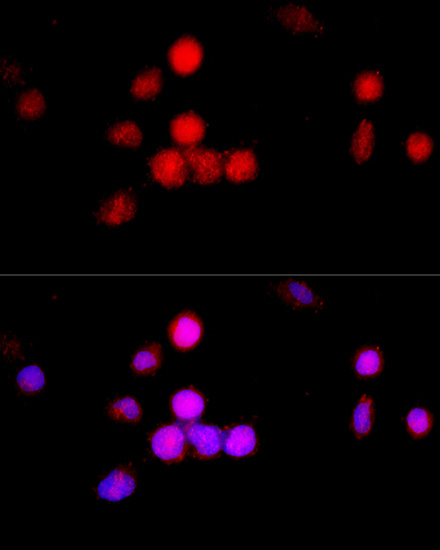 Immunofluorescence analysis of 293T cells using CCNA2 Polyclonal Antibody at dilution of  1:100 (40x lens). Blue: DAPI for nuclear staining.