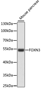 Western blot analysis of extracts of Mouse pancreas using FOXN3 Polyclonal Antibody at dilution of 1:1000.