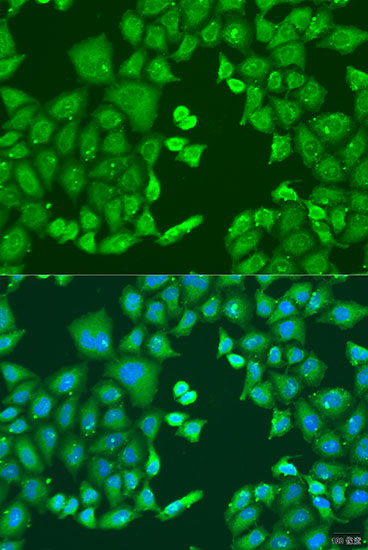 Immunofluorescence analysis of U2OS cells using CYP11B1 Polyclonal Antibody at dilution of  1:100. Blue: DAPI for nuclear staining.