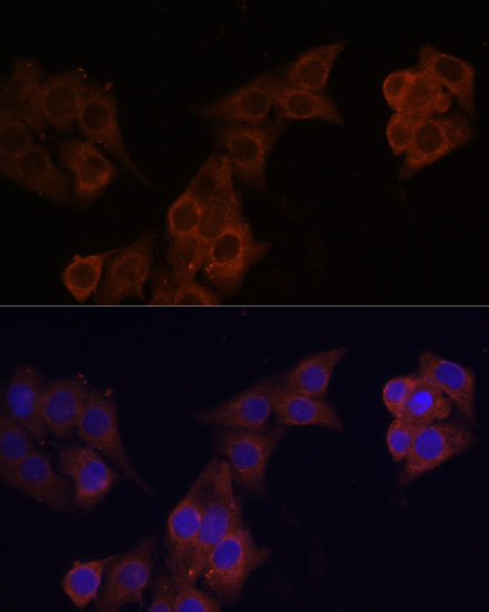 Immunofluorescence analysis of HeLa cells using DCN Polyclonal Antibody at dilution of  1:100 (40x lens). Blue: DAPI for nuclear staining.