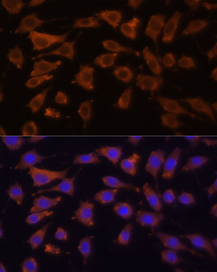 Immunofluorescence analysis of L929 cells using DCN Polyclonal Antibody at dilution of  1:100 (40x lens). Blue: DAPI for nuclear staining.