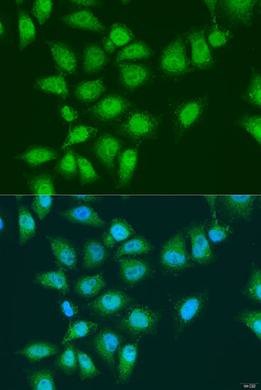Immunofluorescence analysis of U2OS cells using EYA3 Polyclonal Antibody at dilution of  1:100. Blue: DAPI for nuclear staining.