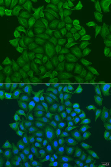 Immunofluorescence analysis of U2OS cells using GSTM3 Polyclonal Antibody at dilution of  1:100. Blue: DAPI for nuclear staining.