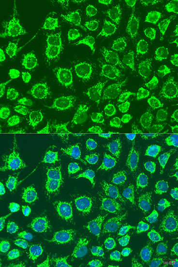 Immunofluorescence analysis of U2OS cells using GYPB Polyclonal Antibody at dilution of  1:100. Blue: DAPI for nuclear staining.