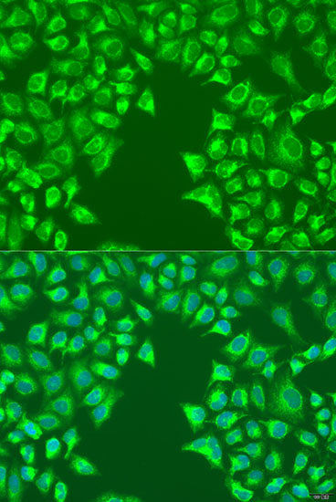 Immunofluorescence analysis of U2OS cells using LRP6 Polyclonal Antibody at dilution of  1:100. Blue: DAPI for nuclear staining.