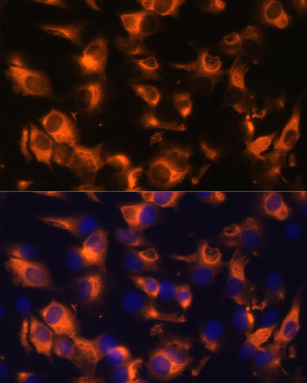 Immunofluorescence analysis of C6 cells using SSTR2 Polyclonal Antibody at dilution of  1:100 (40x lens). Blue: DAPI for nuclear staining.