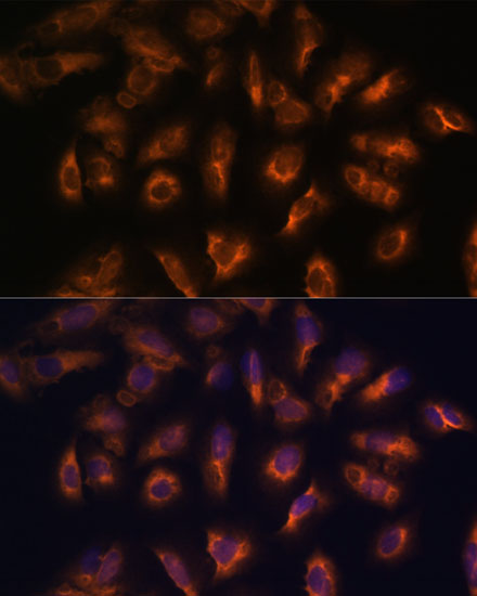 Immunofluorescence analysis of U-2 OS cells using SSTR2 Polyclonal Antibody at dilution of  1:100 (40x lens). Blue: DAPI for nuclear staining.