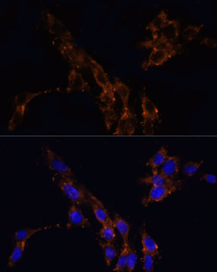 Immunofluorescence analysis of NIH/3T3 cells using TGFB1 Polyclonal Antibody at dilution of  1:100. Blue: DAPI for nuclear staining.