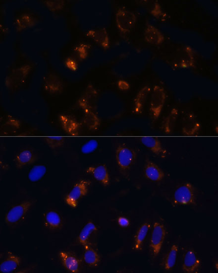 Immunofluorescence analysis of U2OS cells using TGFB1 Polyclonal Antibody at dilution of  1:100. Blue: DAPI for nuclear staining.