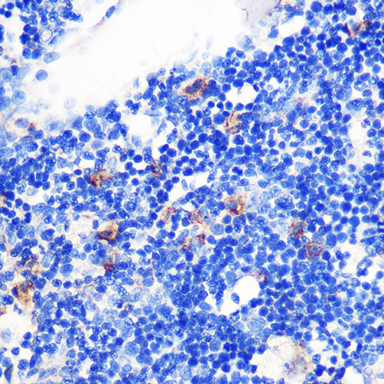 Immunohistochemistry of paraffin-embedded Rat bone marrow using TGFB1 Polyclonal Antibody at dilution of  1:100 (40x lens).