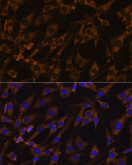 Immunofluorescence analysis of C6 cells using EIF5B Polyclonal Antibody at dilution of  1:100. Blue: DAPI for nuclear staining.