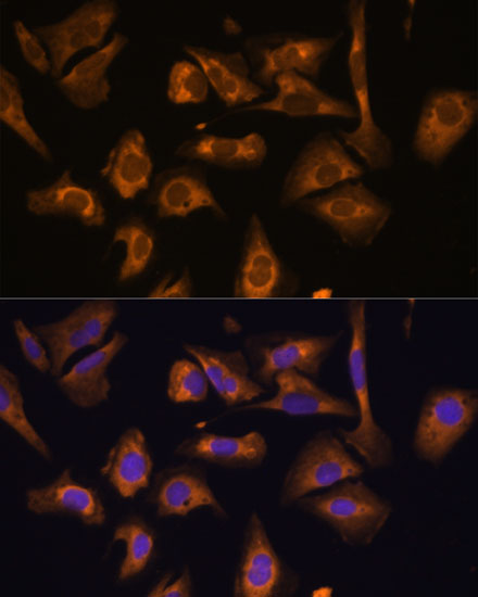 Immunofluorescence analysis of U-2 OS cells using EIF5B Polyclonal Antibody at dilution of  1:100. Blue: DAPI for nuclear staining.