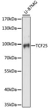 Western blot analysis of extracts of U-87MG cells using TCF25 Polyclonal Antibody at dilution of 1:1000.