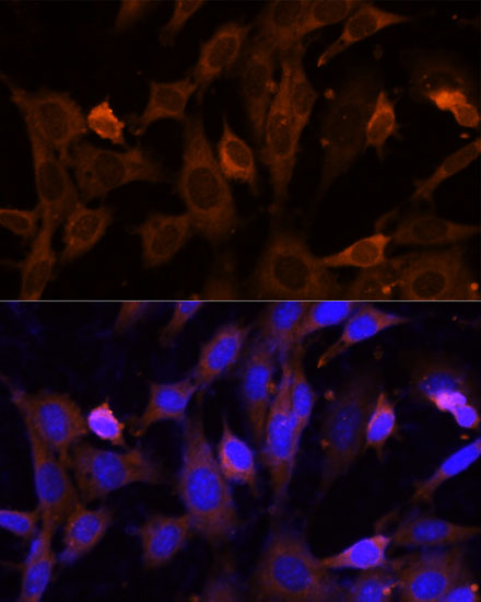 Immunofluorescence analysis of NIH-3T3 cells using VPS36 Polyclonal Antibody at dilution of  1:100 (40x lens). Blue: DAPI for nuclear staining.