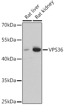 Western blot analysis of extracts of various cell lines using VPS36 Polyclonal Antibody at dilution of 1:3000.