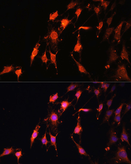 Immunofluorescence analysis of C6 cells using PRR5 Polyclonal Antibody at dilution of  1:100. Blue: DAPI for nuclear staining.