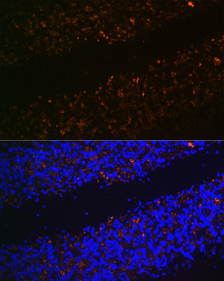 Immunofluorescence analysis of Rat brain using SLC17A6 Polyclonal Antibody at dilution of  1:100 (40x lens). Blue: DAPI for nuclear staining.