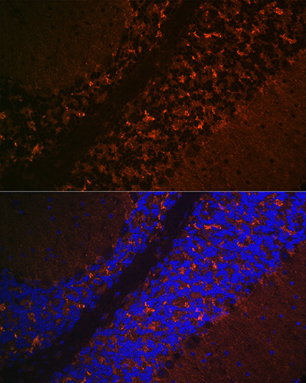 Immunofluorescence analysis of Mouse brain using SLC17A6 Polyclonal Antibody at dilution of  1:100 (40x lens). Blue: DAPI for nuclear staining.