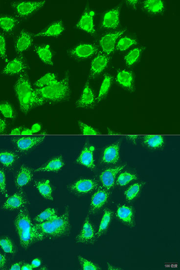 Immunofluorescence analysis of U2OS cells using MCCC2 Polyclonal Antibody at dilution of  1:100. Blue: DAPI for nuclear staining.