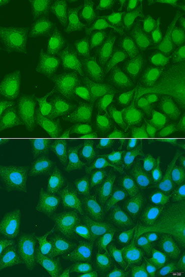 Immunofluorescence analysis of U2OS cells using ATG4C Polyclonal Antibody at dilution of  1:100. Blue: DAPI for nuclear staining.