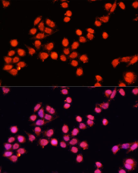 Immunofluorescence analysis of Hela cells using SLC24A5 Polyclonal Antibody at dilution of  1:100 (40x lens). Blue: DAPI for nuclear staining.