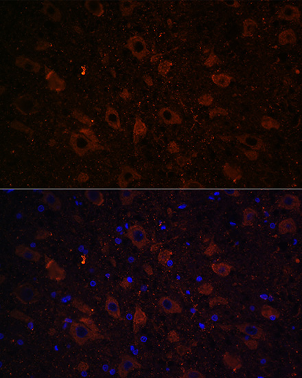 Immunofluorescence analysis of Rat brain using SLC6A3 Polyclonal Antibody at dilution of  1:100 (40x lens). Blue: DAPI for nuclear staining.