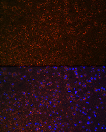 Immunofluorescence analysis of Mouse brain using SLC6A3 Polyclonal Antibody at dilution of  1:100 (40x lens). Blue: DAPI for nuclear staining.