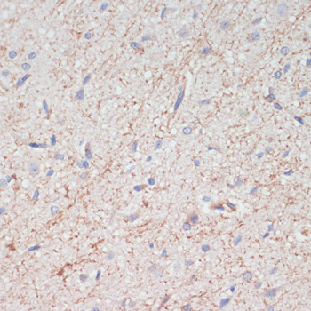 Immunohistochemistry of paraffin-embedded Rat brain using SLC6A3 Polyclonal Antibody at dilution of  1:200 (40x lens).