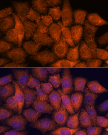 Immunofluorescence analysis of HeLa cells using RPAP3 Polyclonal Antibody at dilution of  1:100. Blue: DAPI for nuclear staining.