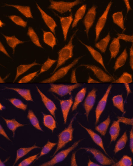 Immunofluorescence analysis of L929 cells using RPAP3 Polyclonal Antibody at dilution of  1:100. Blue: DAPI for nuclear staining.