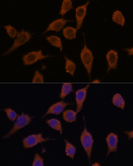 Immunofluorescence analysis of L929 cells using SEC23IP Polyclonal Antibody at dilution of  1:100. Blue: DAPI for nuclear staining.