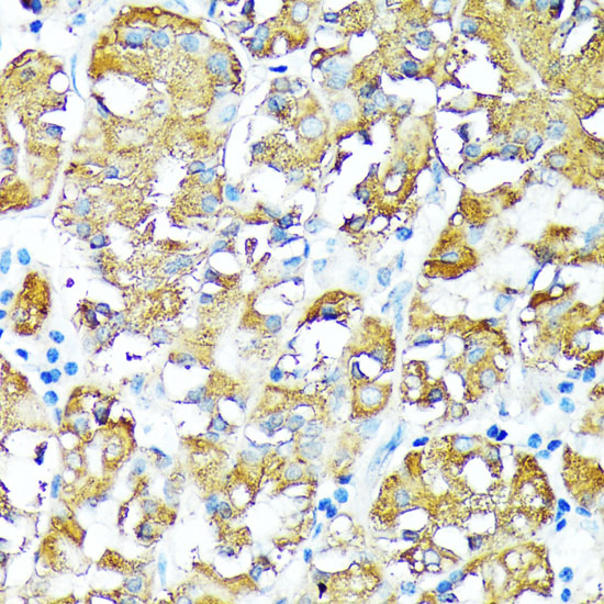 Immunohistochemistry of paraffin-embedded Human stomach using TNFR1 Polyclonal Antibody at dilution of  1:100 (40x lens).