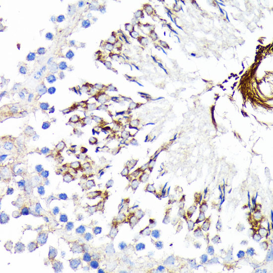 Immunohistochemistry of paraffin-embedded Rat testis using TNFR1 Polyclonal Antibody at dilution of  1:100 (40x lens).