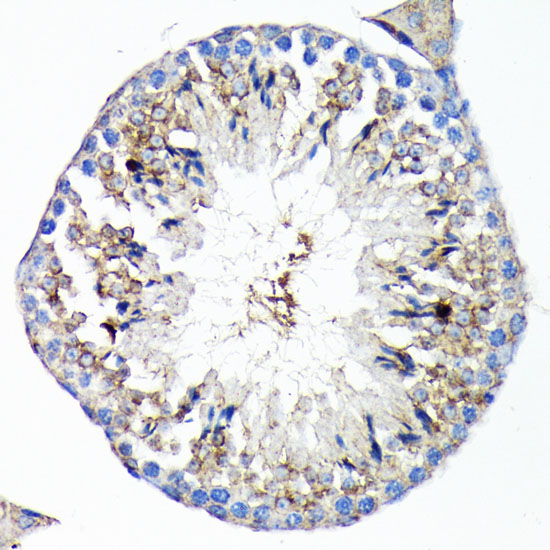 Immunohistochemistry of paraffin-embedded Mouse testis using TNFR1 Polyclonal Antibody at dilution of  1:100 (40x lens).