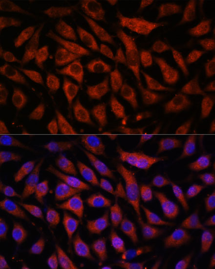 Immunofluorescence analysis of L929 cells using STK38L Polyclonal Antibody at dilution of  1:100. Blue: DAPI for nuclear staining.