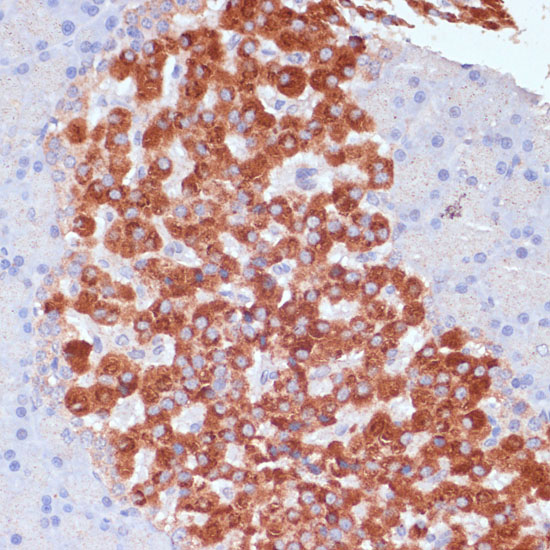 Immunohistochemistry of paraffin-embedded Rat pancreas using KANK2 Polyclonal Antibody at dilution of  1:100 (40x lens).