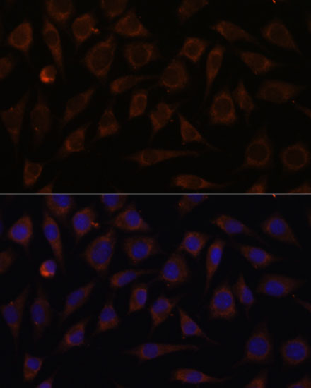 Immunofluorescence analysis of L929 cells using VILL Polyclonal Antibody at dilution of  1:100. Blue: DAPI for nuclear staining.