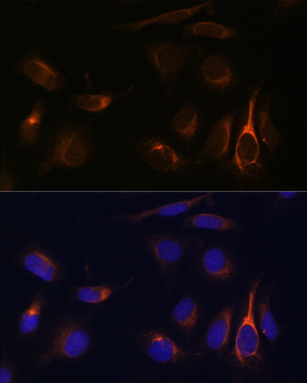 Immunofluorescence analysis of U-2 OS cells using VMP1 Polyclonal Antibody at dilution of  1:100 (40x lens). Blue: DAPI for nuclear staining.