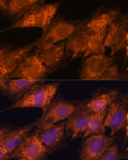 Immunofluorescence analysis of C6 cells using IPO4 Polyclonal Antibody at dilution of  1:100. Blue: DAPI for nuclear staining.